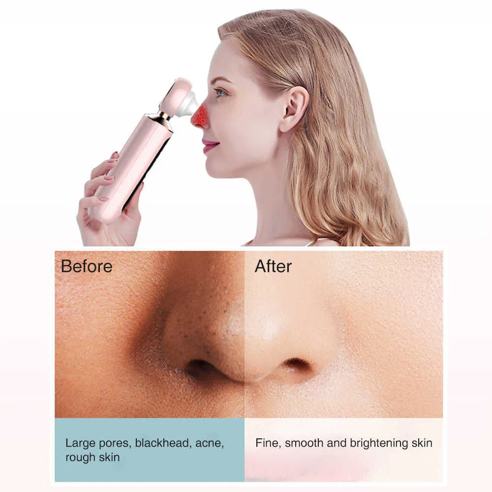 Blackhead Suction Machine