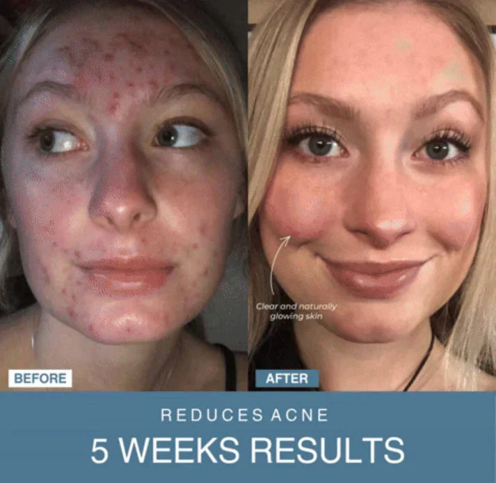 7-in-1 LED Anti-Aging/Wrinkle Apparatus